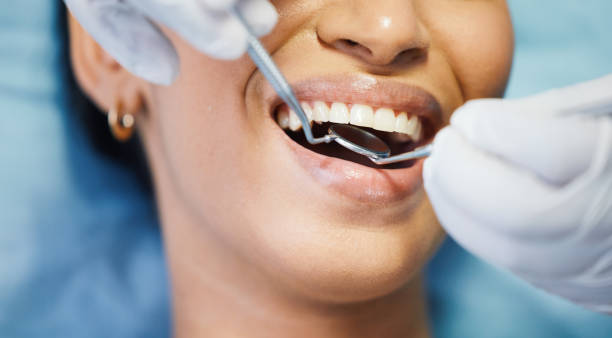Best Emergency Dental Care for Broken or Chipped Teeth in Holmes Beach, FL